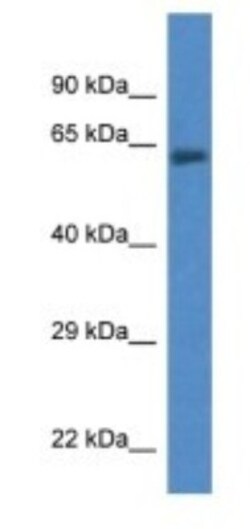 ACSF2 Antibody, Novus Biologicals 100 &mu;L | Buy Online | Novus Biologicals | Fisher Scientific