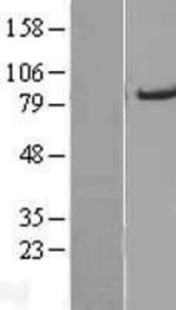 Novus Biologicals™ ACSL5 Overexpression Lysate