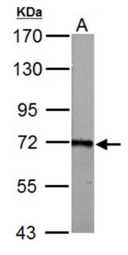 ACSL6 Antibody, Novus Biologicals 0.1mL; Unlabeled:Antibodies, Polyclonal