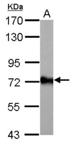 ACSL6 Antibody, Novus Biologicals 0.1mL; Unlabeled:Antibodies, Polyclonal