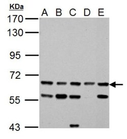 ACSL6 Antibody, Novus Biologicals 0.1mL; Unlabeled:Antibodies, Polyclonal