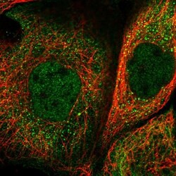 ACSL6 Antibody, Novus Biologicals 0.1mL; Unlabeled:Antibodies, Polyclonal