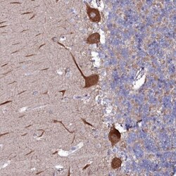 ACSL6 Antibody, Novus Biologicals 0.1mL; Unlabeled:Antibodies, Polyclonal