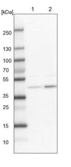 ACSL6 Antibody, Novus Biologicals 0.1mL; Unlabeled:Antibodies, Polyclonal