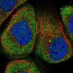 ACSM1 Antibody, Novus Biologicals 25 &mu;L; Unlabeled:Antibodies, Polyclonal