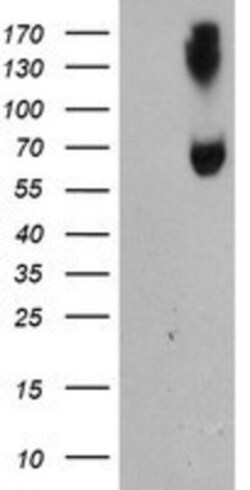 ACSM5 Antibody (OTI1G1), Novus Biologicals 0.1mL; Unlabeled:Antibodies,