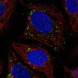 ACSM5 Antibody, Novus Biologicals 0.1mL; Unlabeled:Antibodies, Polyclonal