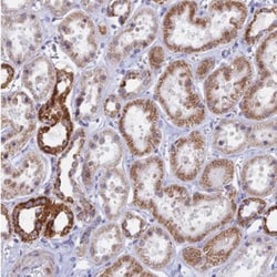 ACSS1 Antibody, Novus Biologicals:Antibodies:Primary Antibodies