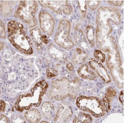 ACSS1 Antibody, Novus Biologicals 0.1mL; Unlabeled:Antibodies, Polyclonal