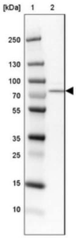 ACSS1 Antibody, Novus Biologicals 0.1mL; Unlabeled:Antibodies, Polyclonal