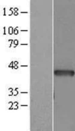 Novus Biologicals™ Actin Alpha 1 Cardiac Muscle Overexpression Lysate
