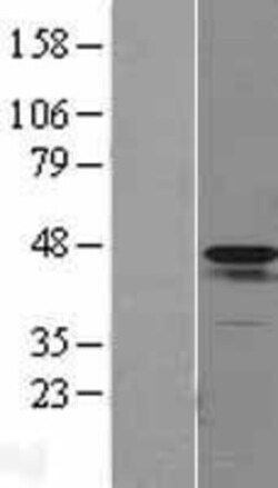 Novus Biologicals™ alpha-Smooth Muscle Actin Overexpression Lysate