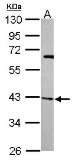 actin-related protein 2/3 complex subunit 1B Antibody, Novus Biologicals