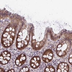 Caspase-9 Antibody, Novus Biologicals 25 &mu;L; Unlabeled:Antibodies, Polyclonal