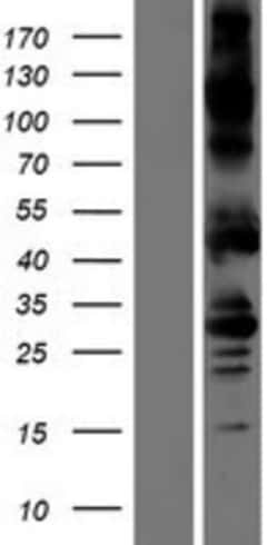 Novus Biologicals&trade;&nbsp;Activin RIA/ALK-2/Activin Receptor Type 1 Overexpression Lysate