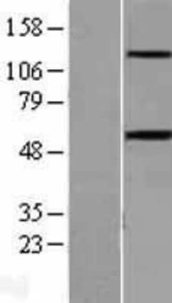 Novus Biologicals&trade;&nbsp;Activin RIB/ALK-4 Overexpression Lysate