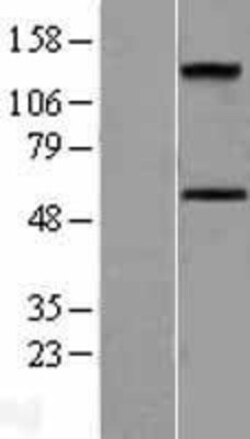 Novus Biologicals™ ALK-7/Activin Receptor Type 1C Overexpression Lysate