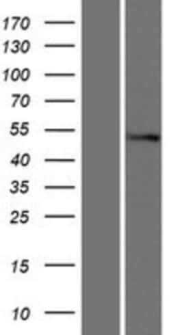Novus Biologicals&trade;&nbsp;ALK-7/Activin Receptor Type 1C Overexpression Lysate