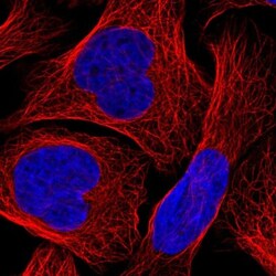 Activin RIIA Antibody, Novus Biologicals 0.1mL; Unlabeled:Antikörper