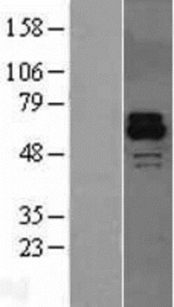 Novus Biologicals™ Activin RIIB Overexpression Lysate