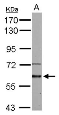 Activin RIA/ALK-2/Activin Receptor Type 1 Antibody, Novus Biologicals 0.1 mL | Buy Online | Novus Biologicals | Fisher Scientific