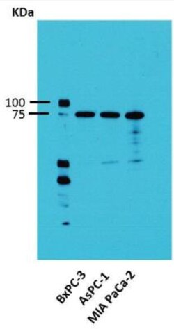 Activin RIA/ALK-2/Activin Receptor Type 1 Antibody, Novus Biologicals 0.1 mL | Buy Online | Novus Biologicals | Fisher Scientific