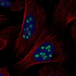 ACTL6B Antibody, Novus Biologicals 0.1mL; Unlabeled:Antibodies, Polyclonal