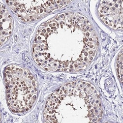 ACTL6B Antibody, Novus Biologicals 0.1mL; Unlabeled:Antibodies, Polyclonal