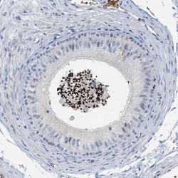 ACTL7A Antibody, Novus Biologicals 0.1mL; Unlabeled:Antibodies, Polyclonal