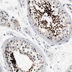 ACTL7B Antibody, Novus Biologicals 0.1mL; Unlabeled:Antibodies, Polyclonal