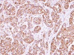 ACTL8 Antibody, Novus Biologicals 0.1mL; Unlabeled:Antibodies, Polyclonal