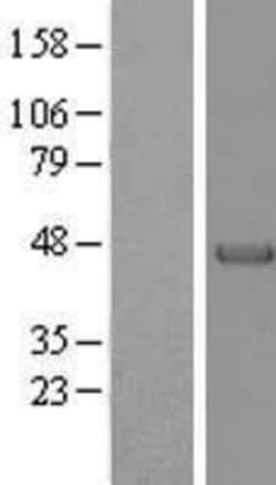 Novus Biologicals&trade;&nbsp;Alpha-parvin/Actopaxin Overexpression Lysate