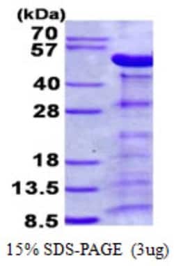 Novus Biologicals&trade;&nbsp;Recombinant Human Alpha-parvin/Actopaxin His Protein