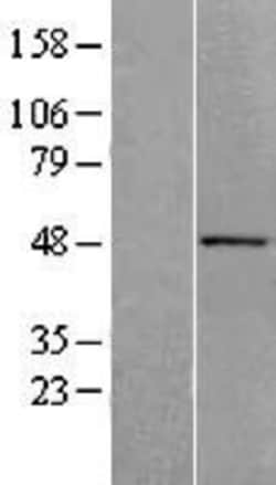 Novus Biologicals&trade;&nbsp;ACTR10 Overexpression Lysate
