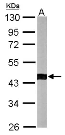 ACTR1B Antibody, Novus Biologicals 0.1mL; Unlabeled:Antibodies, Polyclonal