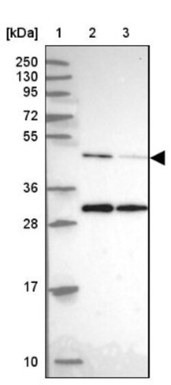 ACTR3 Antibody, Novus Biologicals 0.1mL; Unlabeled:Antibodies, Polyclonal