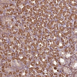 ACTR3 Antibody, Novus Biologicals 0.1mL; Unlabeled:Antibodies, Polyclonal