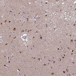 ACTR5 Antibody, Novus Biologicals:Antibodies:Primary Antibodies