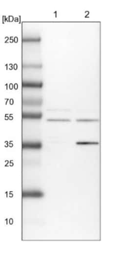 ACTR6 Antibody, Novus Biologicals 0.1mL; Unlabeled:Antibodies, Polyclonal