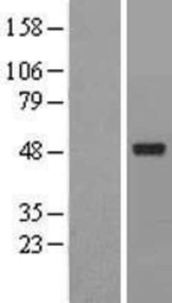Novus Biologicals™ ACTR6 Overexpression Lysate