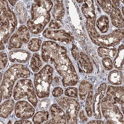 ACTR6 Antibody, Novus Biologicals 0.1mL; Unlabeled:Antibodies, Polyclonal