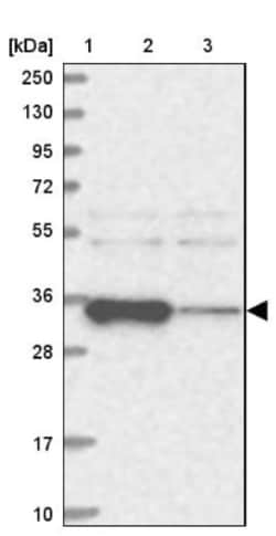 ACTR6 Antibody, Novus Biologicals 0.1mL; Unlabeled:Antibodies, Polyclonal