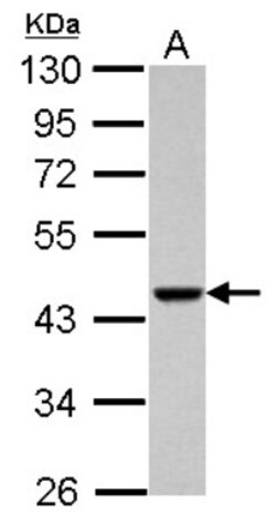 ACTRT1 Antibody, Novus Biologicals 0.1 mL | Buy Online | Novus Biologicals | Fisher Scientific