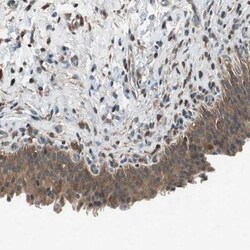 ACTRT2 Antibody, Novus Biologicals:Antibodies:Primary Antibodies
