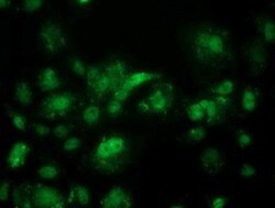 ACY3 Antibody (OTI2D5), Novus Biologicals 0.1mL; Unlabeled:Antibodies,