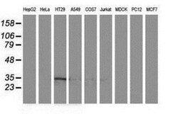ACY3 Antibody (OTI2D5), Novus Biologicals 0.1mL; Unlabeled:Antibodies,