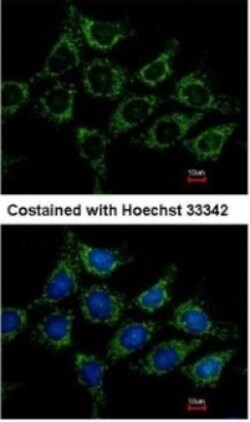 Acylglycerol Kinase Antibody, Novus Biologicals 0.1mL; Unlabeled:Antibodies,
