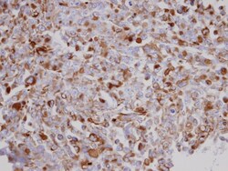 Acylglycerol Kinase Antibody, Novus Biologicals 0.1mL; Unlabeled:Antibodies,