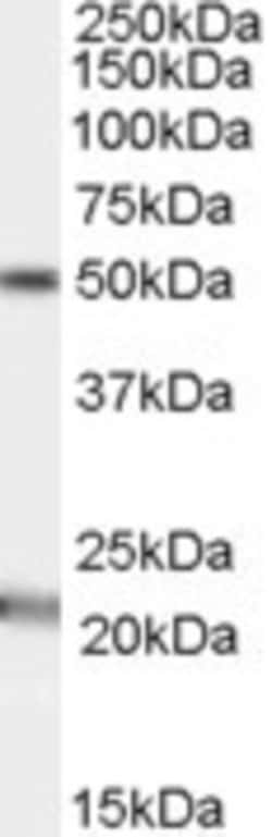Acylglycerol Kinase Antibody, Novus Biologicals 0.1mg; Unlabeled:Antibodies,