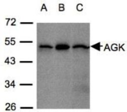 Acylglycerol Kinase Antibody, Novus Biologicals 0.1mL; Unlabeled:Antibodies,